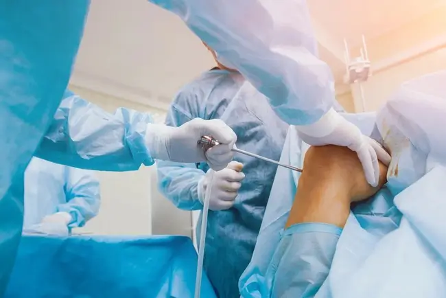 Artroscopia de rodilla en Monterrey